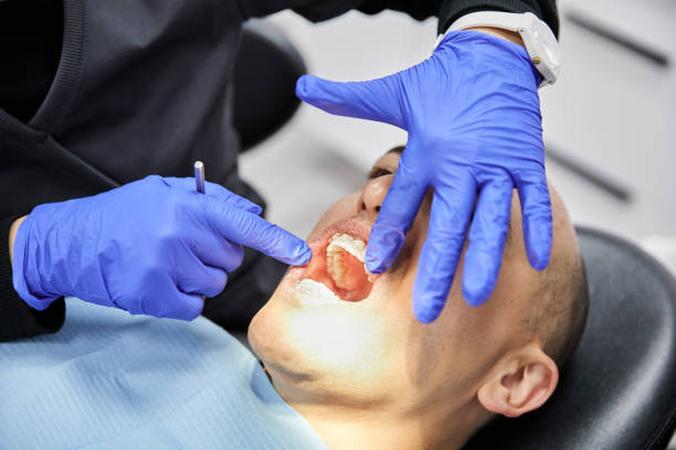 Best Emergency Dental Care for Broken or Chipped Teeth in Kirby, TX
